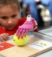 В Приамурье региональное отделение Фонда обеспечило современным протезом 7-летнюю девочку